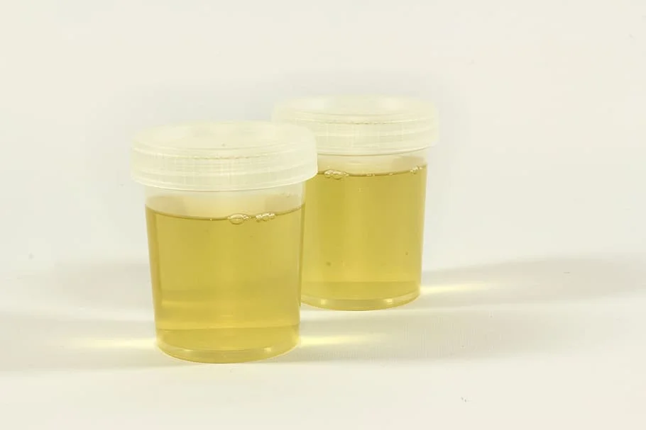 Can Labs Tell The Difference Between Real And Synthetic Urine?