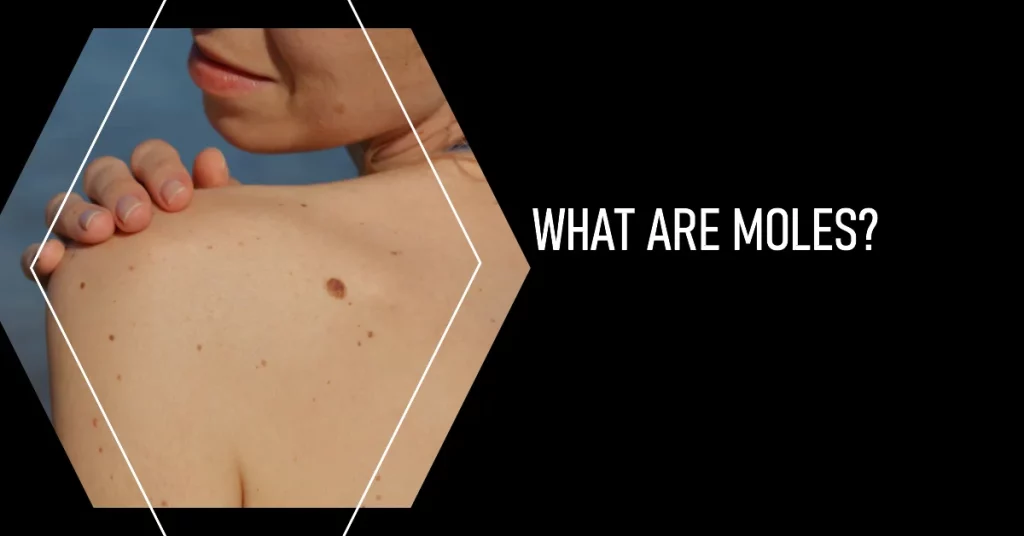 What is Moles