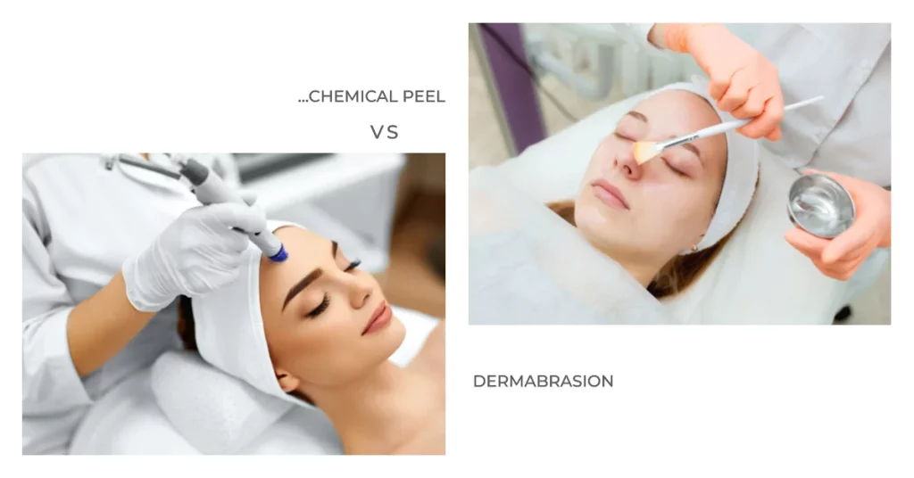 What is Differences Between Dermabrasion and Chemical Peel 